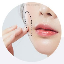 볼