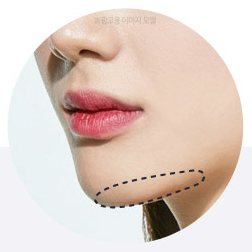 턱라인