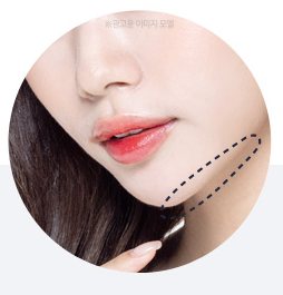 턱라인