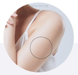 두꺼운 팔 바깥쪽