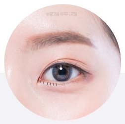 피부 봉합