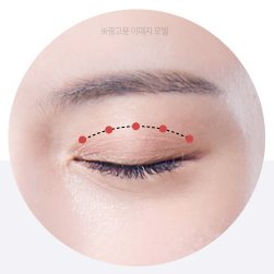 작은 절개창