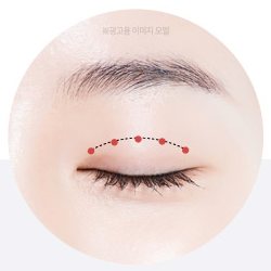 작은 절개창