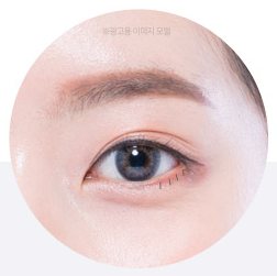 피부 봉합
