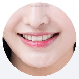 팔자주름, 처진 볼살
