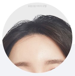 이마주름