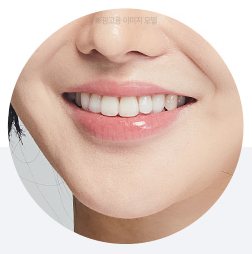 팔자주름, 볼살/턱살