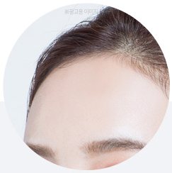 이마