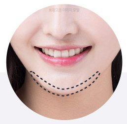 이중턱 부위를 점선으로 표시한 웃는 입가