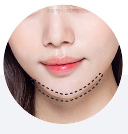 턱 밑을 점선으로 표시한 입가