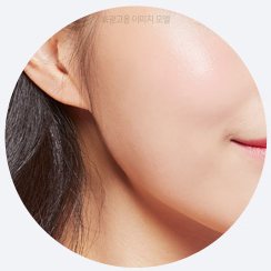 시술 부위 원형 사진 — 귀·볼·턱선(원본 이름 '미간')