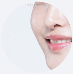 시술 부위 원형 사진 — 광대(옆얼굴)