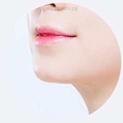 시술 부위 원형 사진 — 턱끝